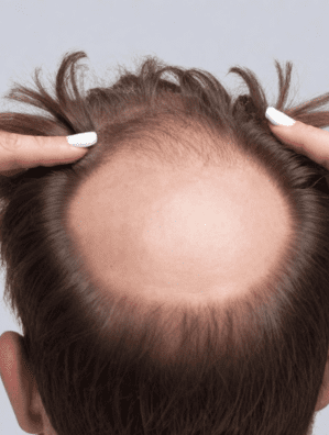 Human Hair Extension